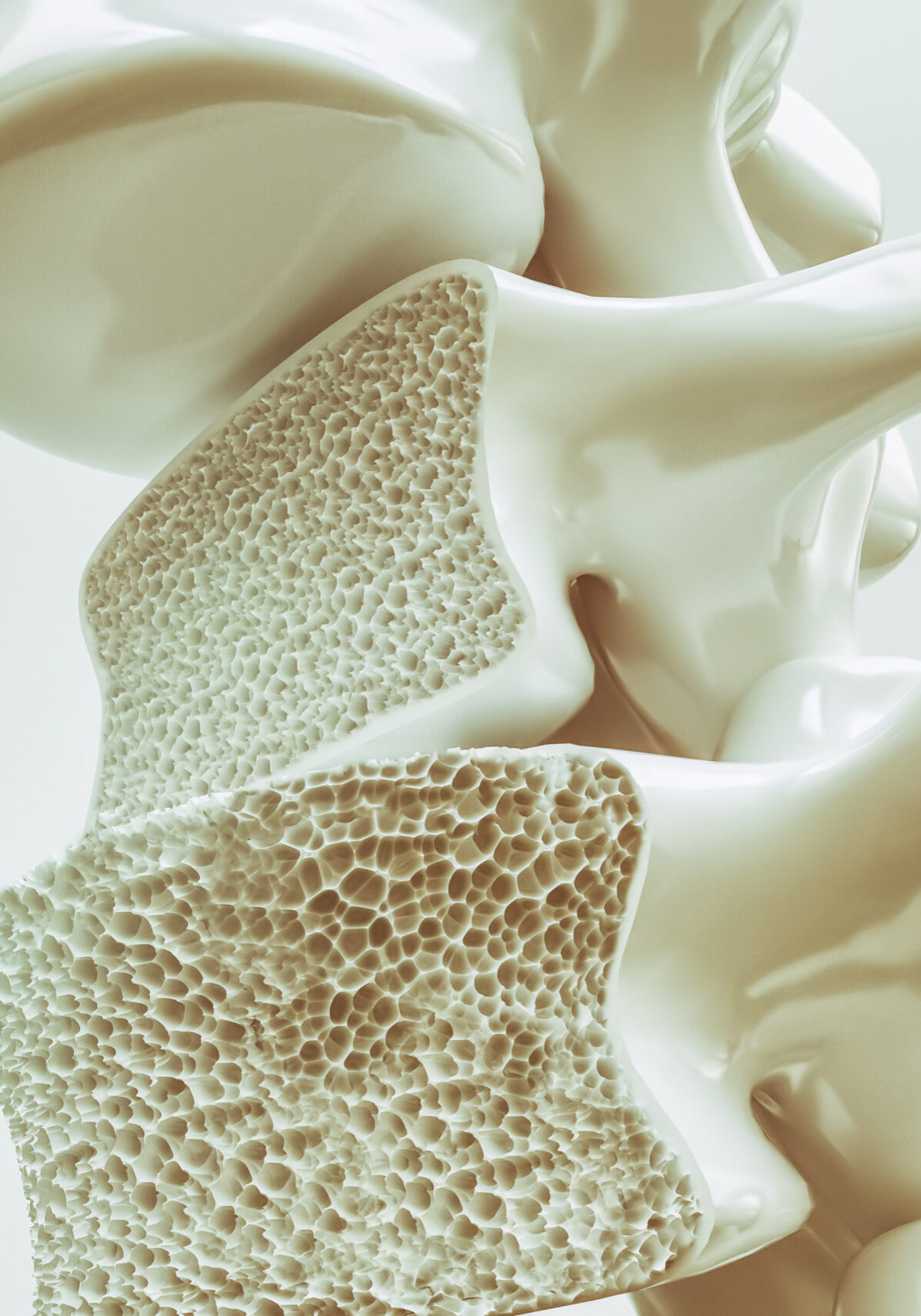 Osteoporosis on the spine -- 3d rendering