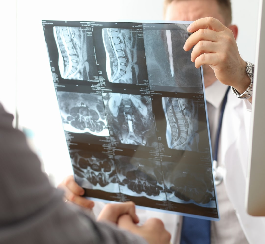 Close-up of male doctor holding spinal x-ray with patient while determining diagnosis of osteoporosis